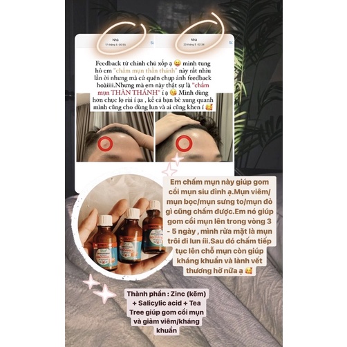 CHẤM MỤN TH.ẦN TH.Á.NH