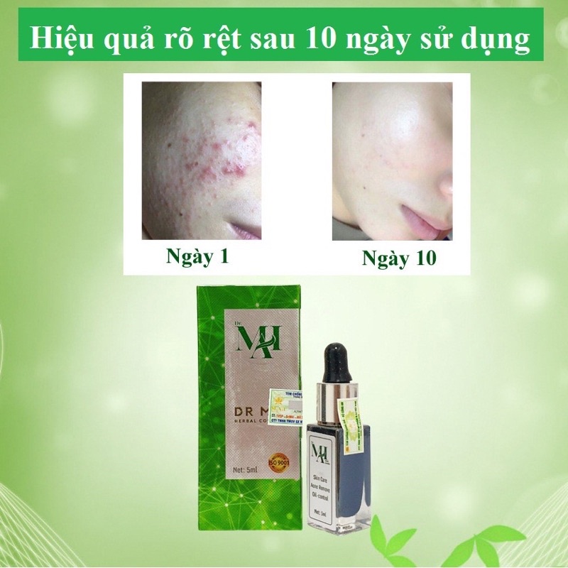 Serum DR MAI nguyên chất sạch mụn thâm 5ml doctor mai dành cho da dầu se kích lỗ chân lông chính hãng