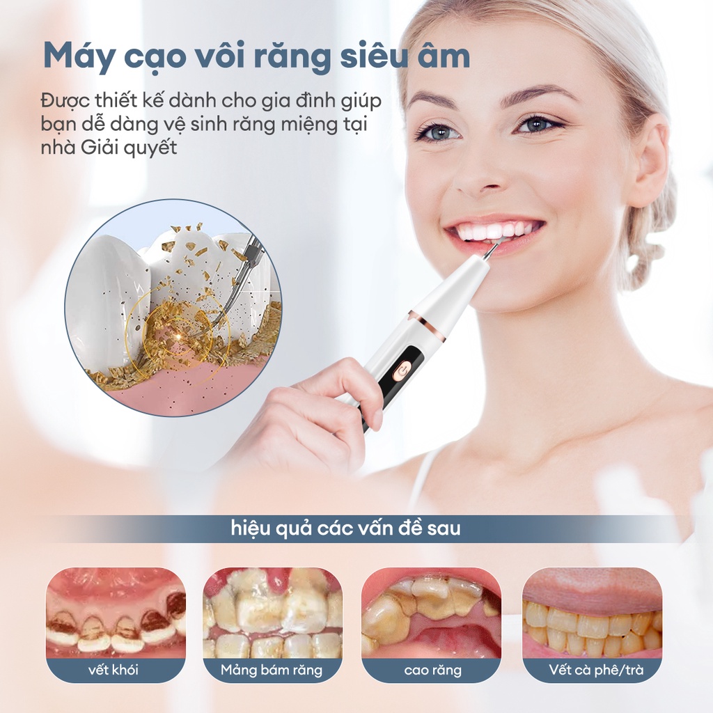 Ckeyin Máy Làm Bánh Tartar Siêu Âm 3 Chế Độ An Toàn KQ158W