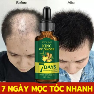 ❤??100% Chính Hãng❤????Hiệu quả sau 7 ngày??Serum mọc tóc Tinh chất dưỡng tóc Tinh Chất Chống Rụng Tóc 30ml kích thích mọc tóc nhanh làm dàygiúp giảm rụng tóc giải quyết vấn đề rụng tóc do lão hóa / hói đầu sau sinh