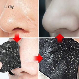ranliy???Miếng dán mũi lột mụn đầu đen làm sạch sâu