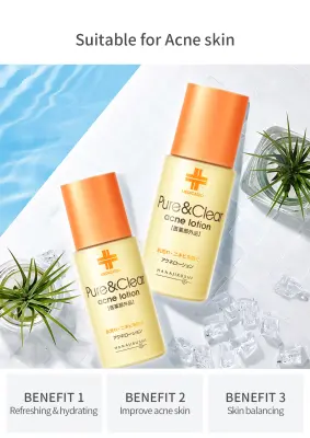 HANAJIRUSHI Toner trị mụn 100ml Nhật Bản Se Lỗ Chân Lông Giảm Mụn