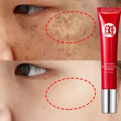 làm trắng và loại bỏ nám tàn nhang hiệu quả loại bỏ các hắc tốt melanin và chăm sóc da trắng sáng tự nhiên Kem chăm sóc da mặt -whitening freckle cream20g