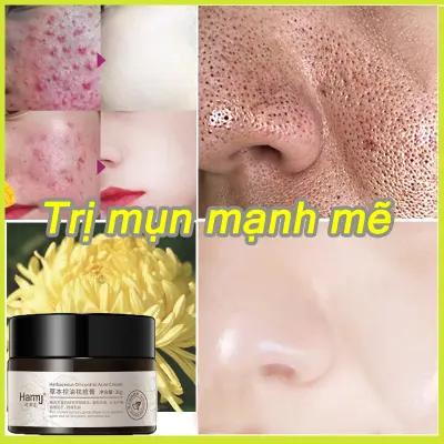 Nơi nhập dữ liệu