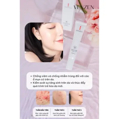 Nơi nhập dữ liệu